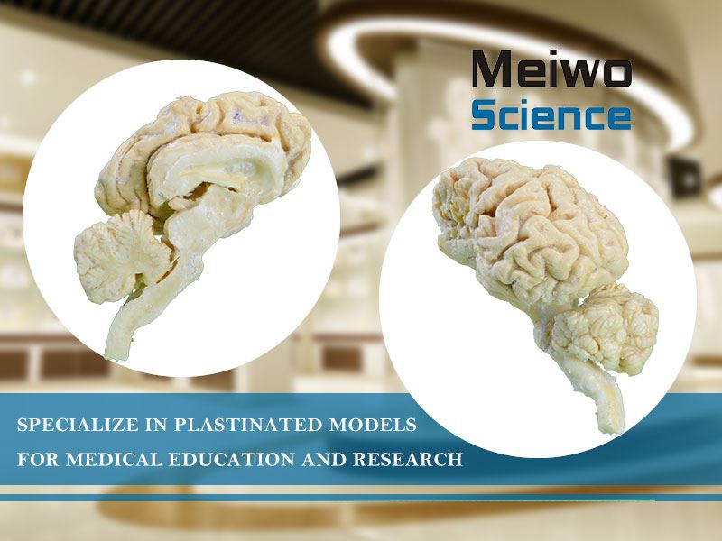 Plasticized Plastinated Brain Hemispheres Of Cow Plasticized Plastinated Brain Hemispheres Of Cow